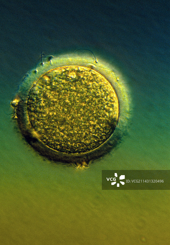 人类精子使卵子受精显微镜照片图片素材