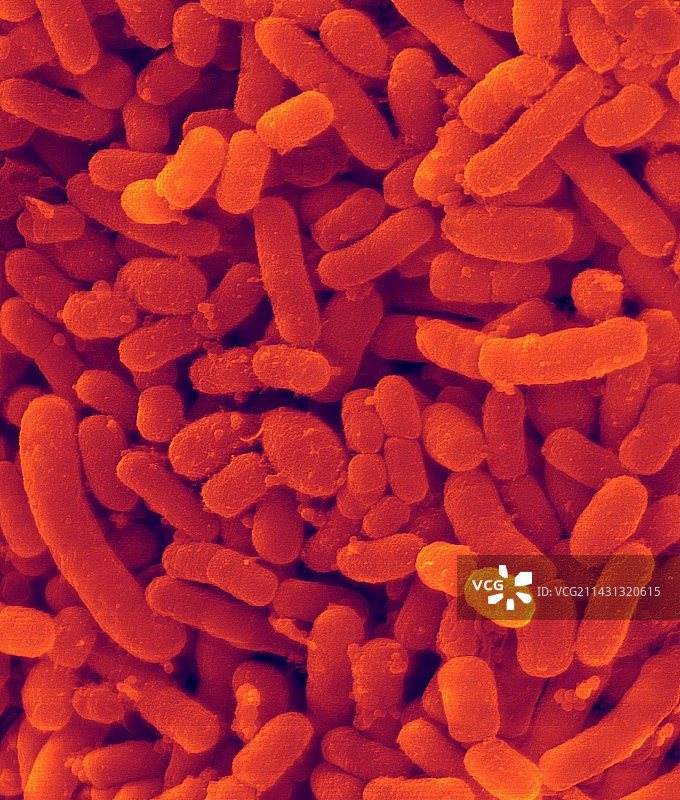 产黑色素普雷沃菌，扫描电镜图片素材