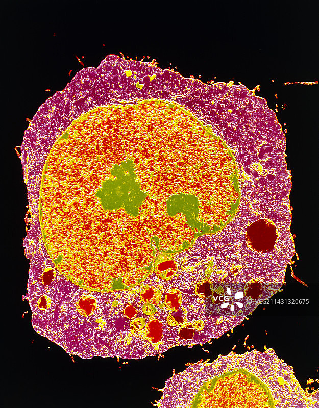 彩色透射电镜下的HeLa细胞切片图片素材