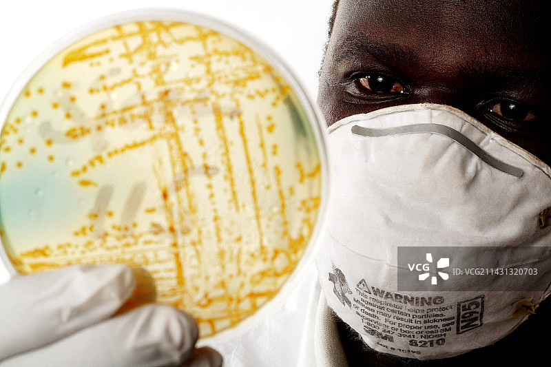 霍乱研究图片素材