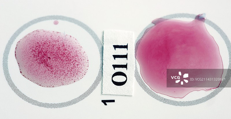 大肠杆菌STEC细菌测试图片素材