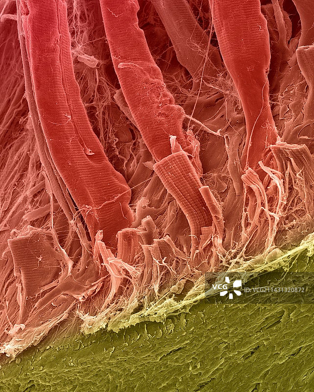 附着在骨表面的肌腱，扫描电镜图图片素材