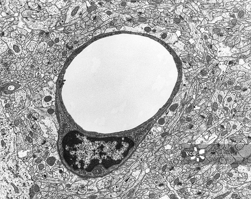 毛细血管和内皮细胞，透射电子显微镜图片素材