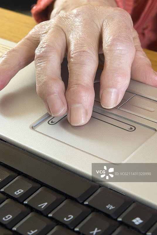 关节炎手指图片素材