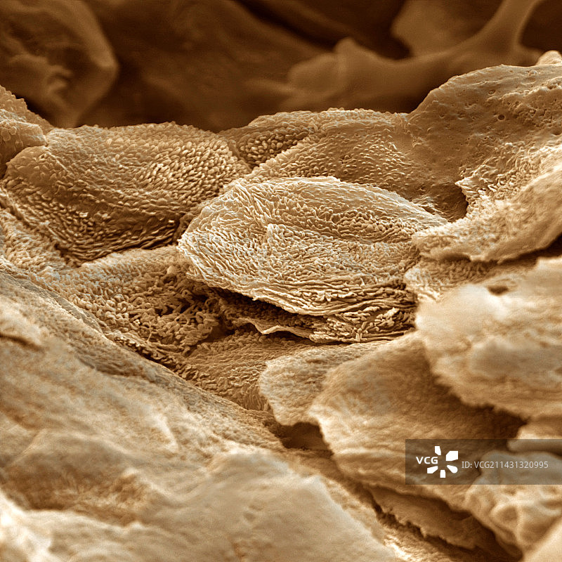 坚硬的皮肤，扫描电镜图片素材