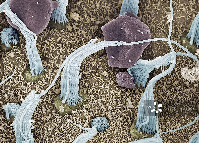 内耳感觉细胞扫描电镜图图片素材