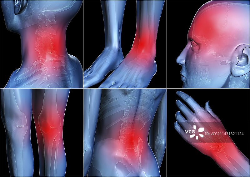 身体疼痛艺术作品图片素材