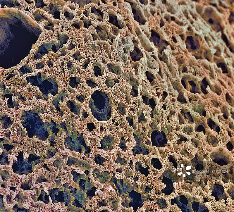 肺泡扫描电镜图图片素材