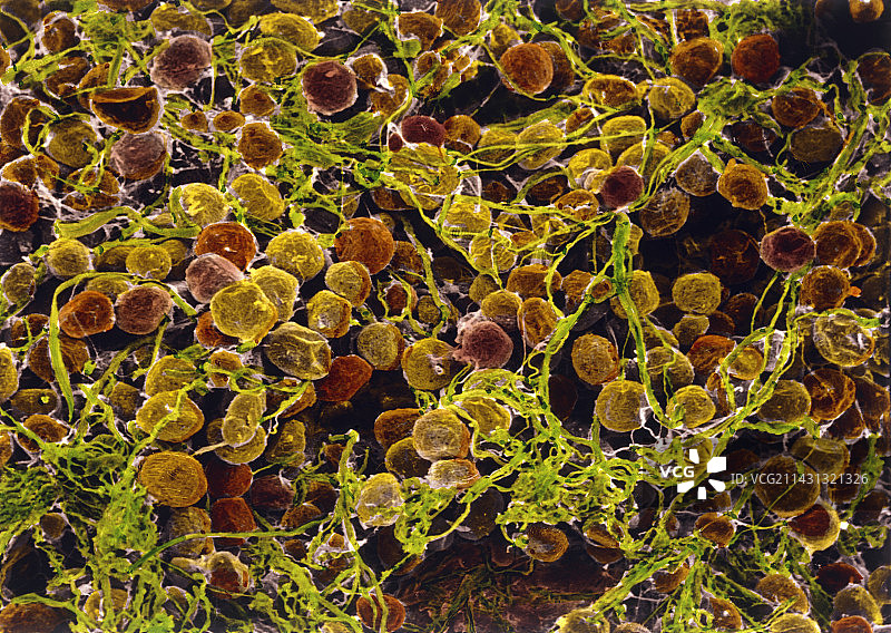 显示脂肪组织的彩色扫描电镜图图片素材