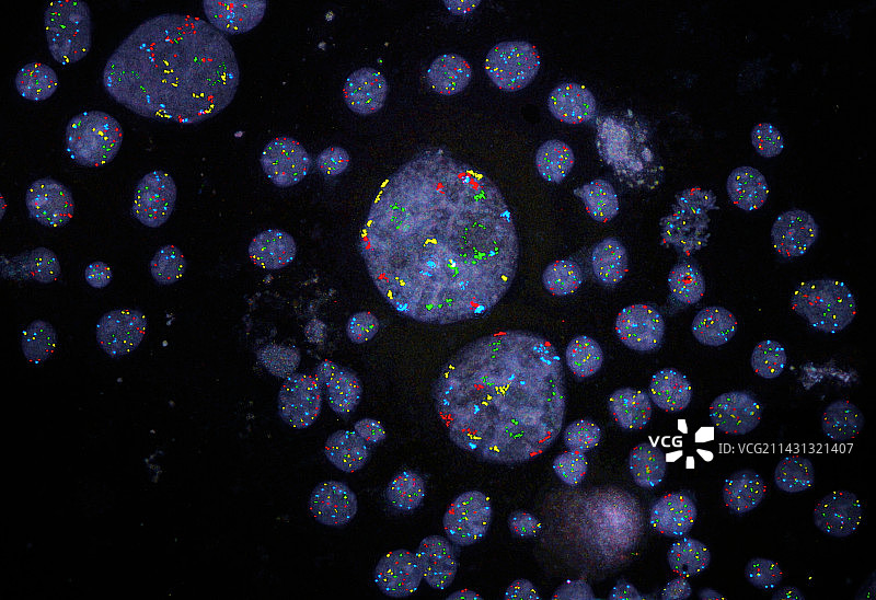乳腺癌中的染色体不稳定性图片素材