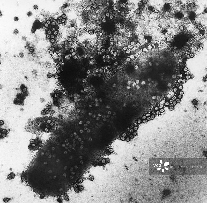 T4噬菌体感染细菌裂解透射电镜照片图片素材