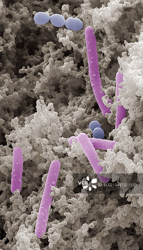 酸奶菌，扫描电镜图片素材