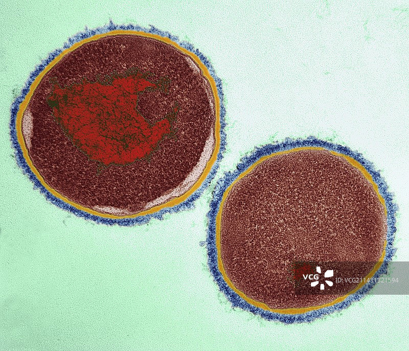 化脓性链球菌（透射电镜）图片素材