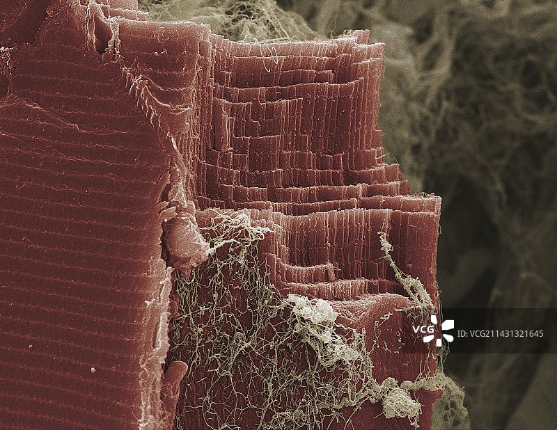 骨骼肌组织扫描电镜图图片素材