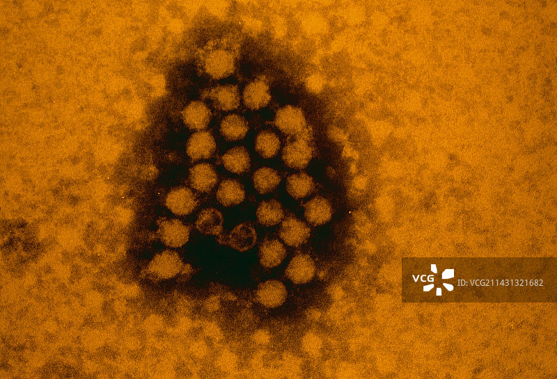 鼻病毒的伪彩TEM图片素材