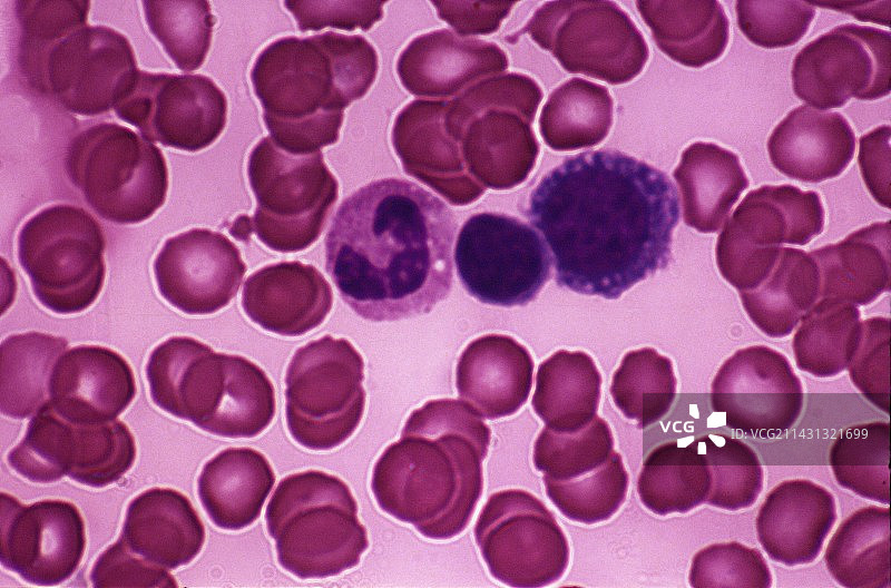 血细胞图片素材