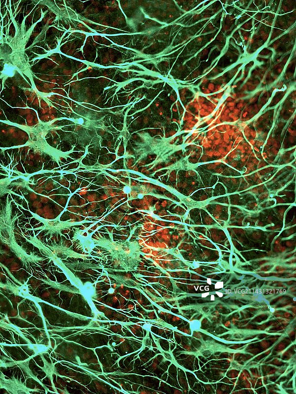 干细胞衍生的神经细胞图片素材