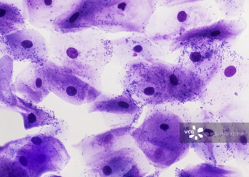 口腔细胞和细菌的显微照片图片素材