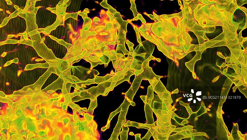 新冠肺炎感染的肺部3D CT扫描图片素材