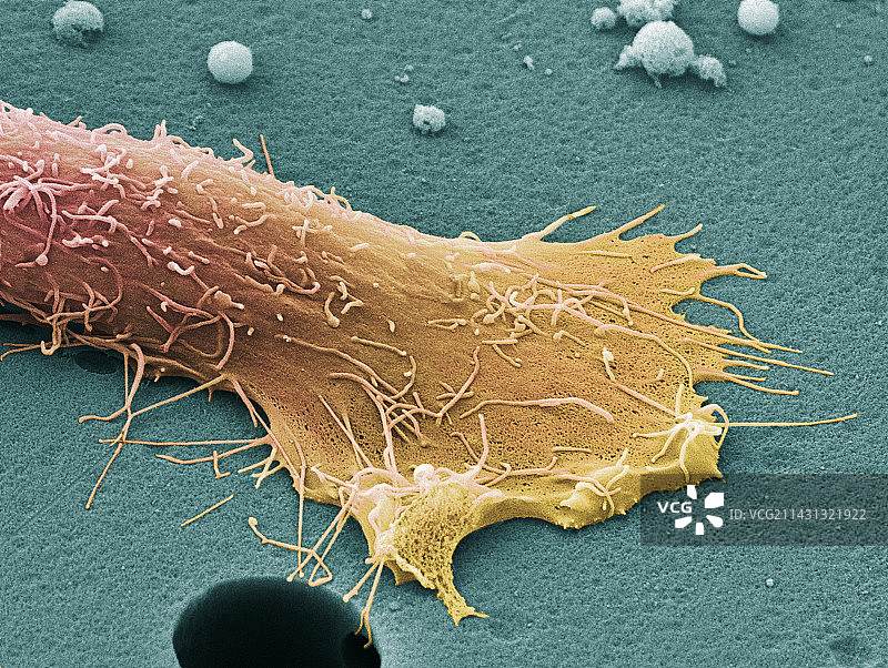 前列腺癌细胞扫描电镜图图片素材