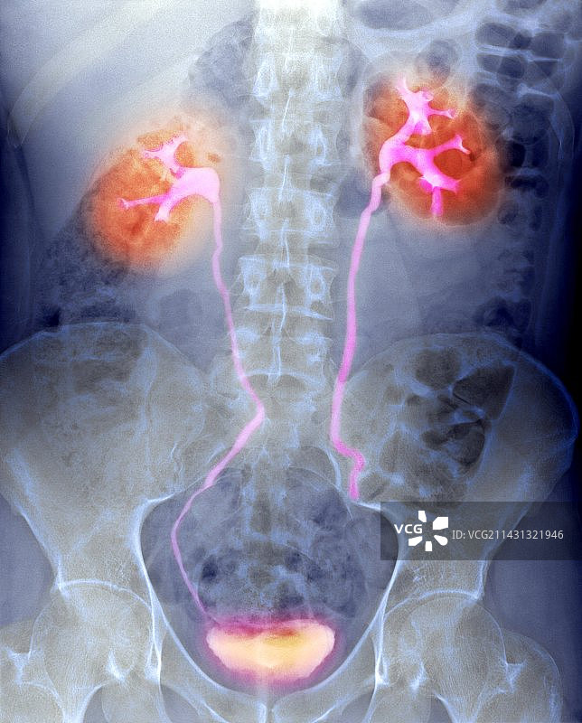 泌尿系统X光片图片素材