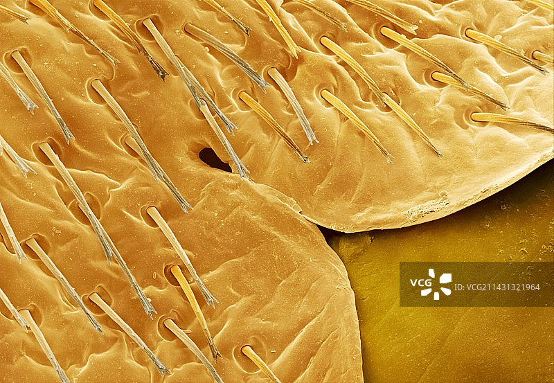 雌性臭虫腹部扫描电镜图图片素材