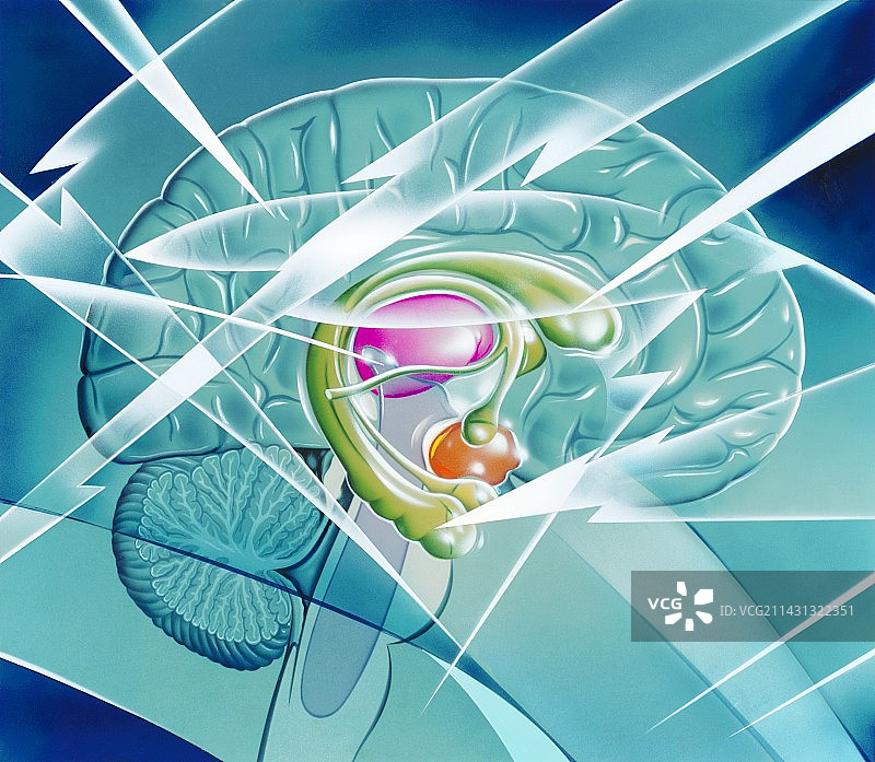 癫痫病中的大脑图片素材