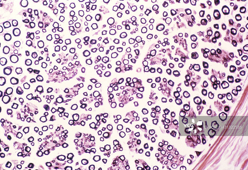 通过周围神经的切片的LM图片素材