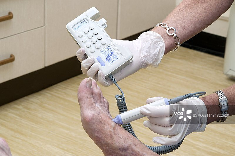 糖尿病患者的足部脉搏测试图片素材