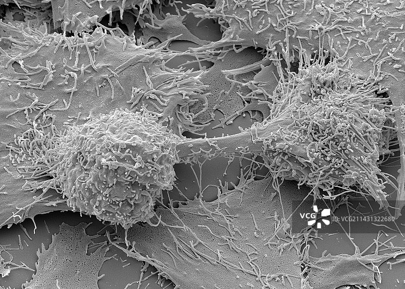 肝癌细胞分裂（扫描电镜）图片素材