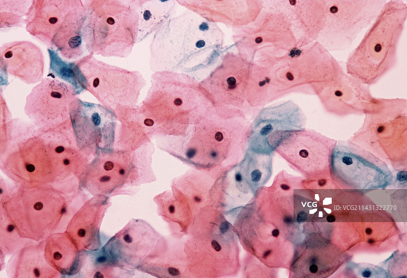 宫颈涂片中正常细胞的显微照片图片素材