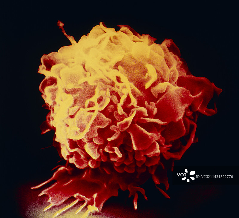 巨噬细胞的彩色扫描电子显微镜图像图片素材