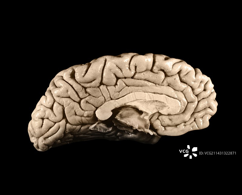 爱因斯坦的大脑图片素材