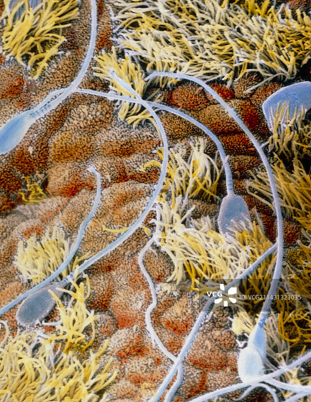 子宫腔内精子的伪彩色扫描电镜图图片素材