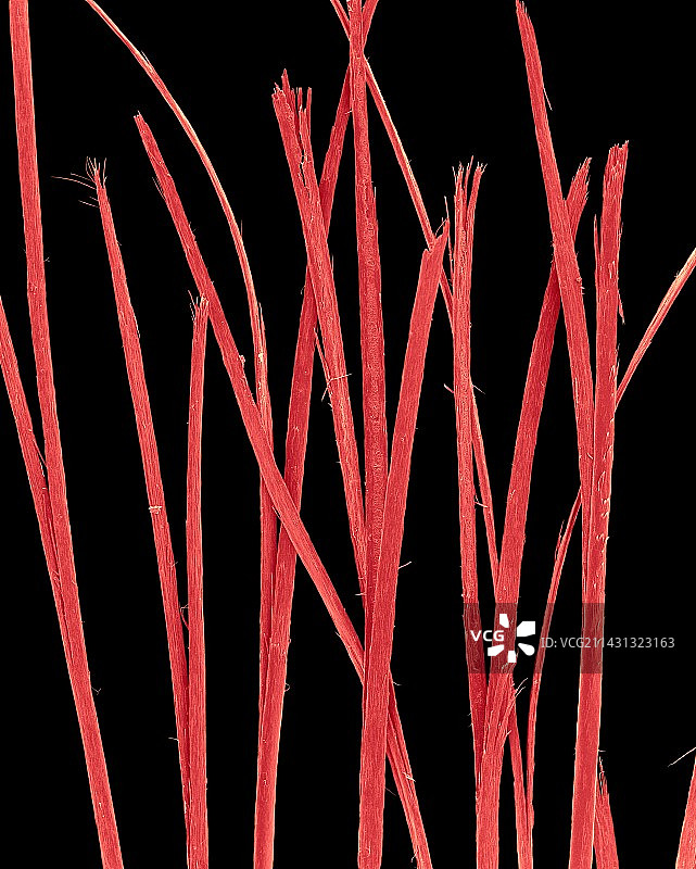 末端开叉的人类头发，扫描电镜图片素材