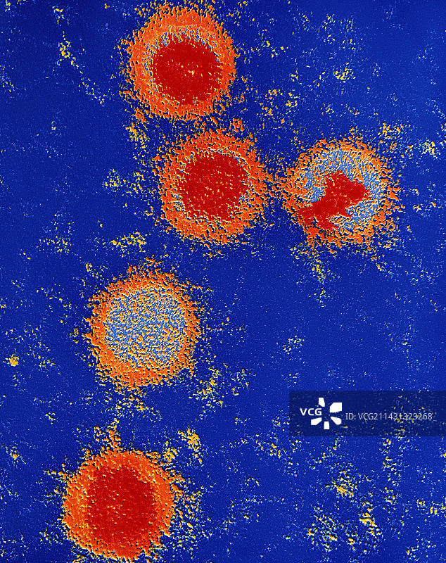 EB病毒图片素材