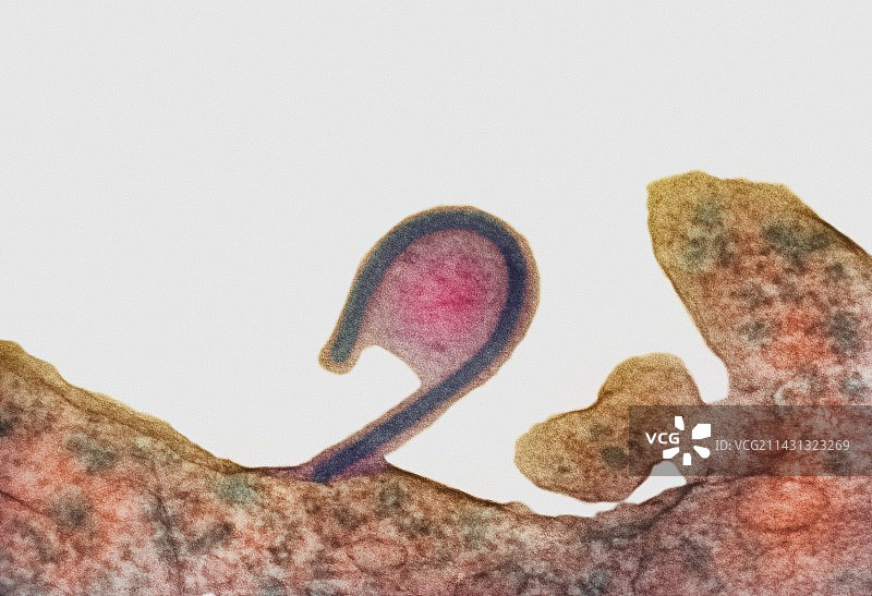 埃博拉病毒TEM图片素材
