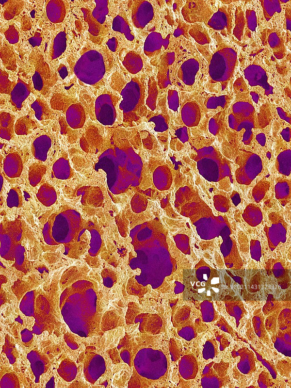 肺泡扫描电镜图图片素材