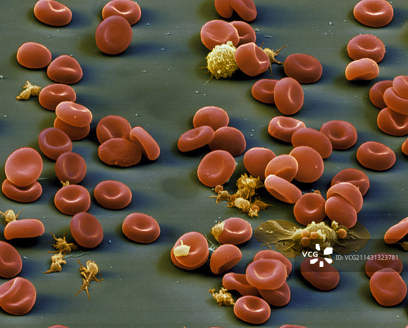红白血细胞和血小板的彩色扫描电镜图图片素材