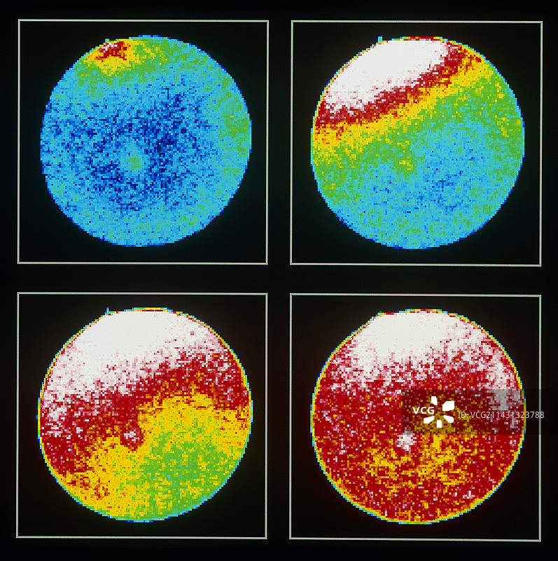 海胆卵受精的共聚焦LM：钙波图片素材