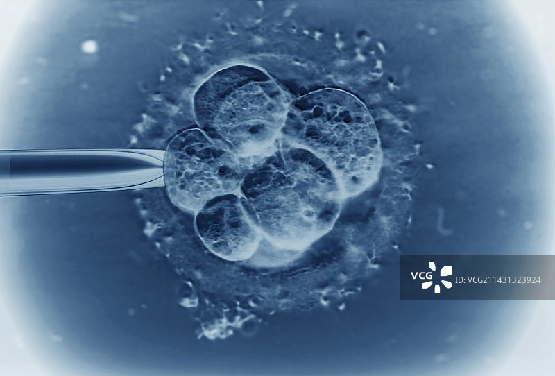 试管婴儿胚胎显微照片图片素材
