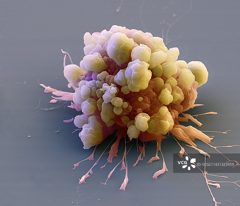 细胞凋亡扫描电镜图图片素材