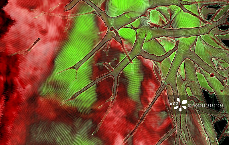 肺部气道3D CT扫描图片素材