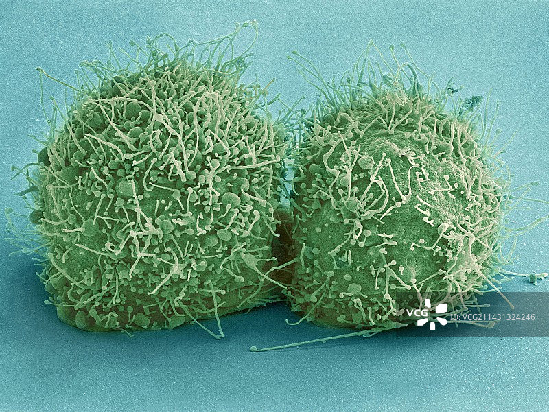 HeLa细胞，扫描电镜图片素材