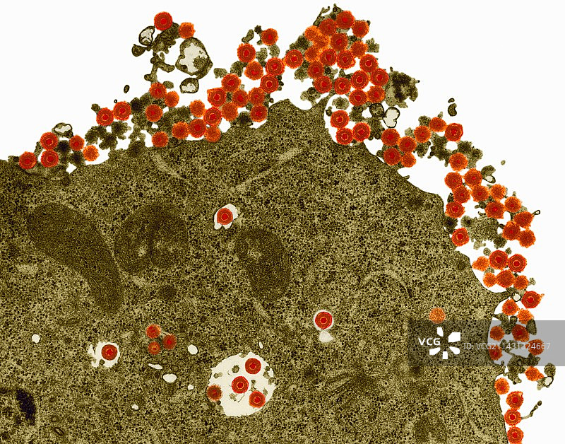 单纯疱疹病毒（透射电镜）图片素材