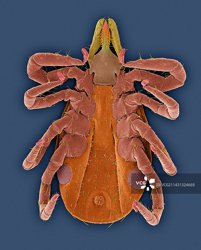 鹿蜱（肩胛硬蜱）扫描电镜图图片素材