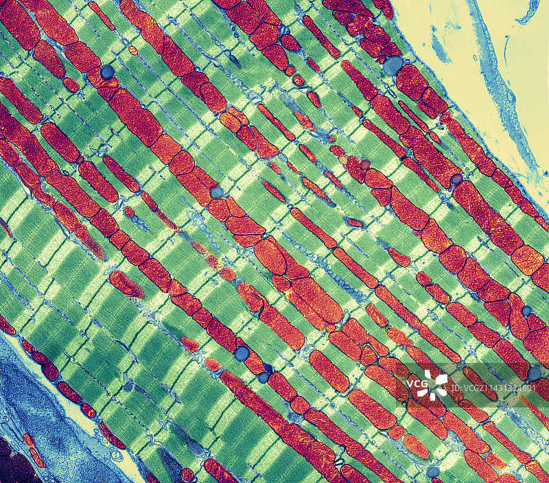 心肌组织TEM图片素材