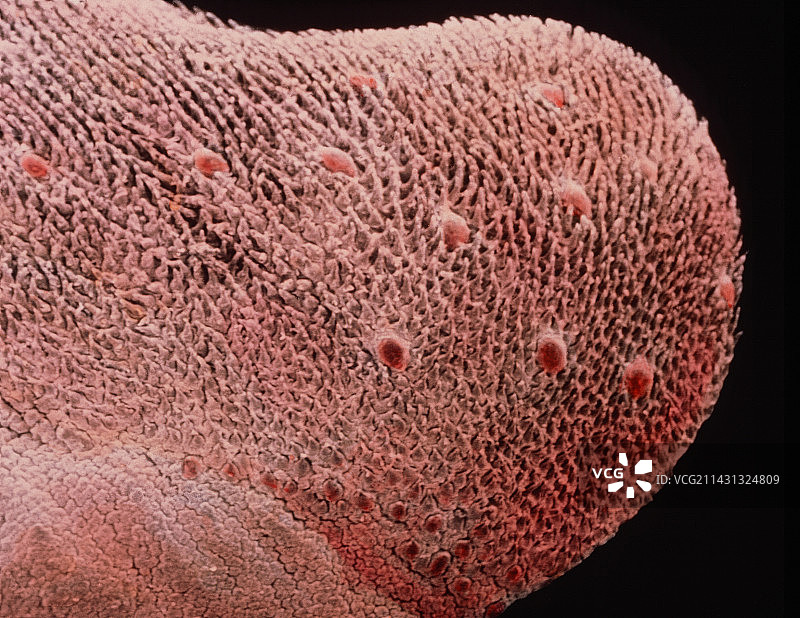 舌背表面的假色扫描电镜图图片素材