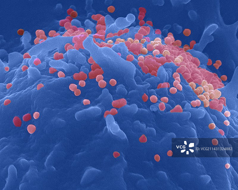 HIV病毒颗粒图片素材