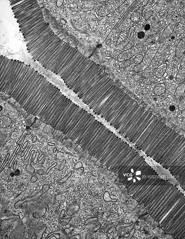 微绒毛，透射电镜图片素材